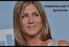 celebrities with turner syndrome